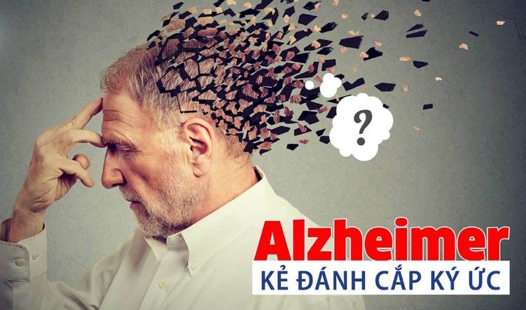 Bệnh Alzheimer là gì ? Nguyên Nhân và Cách Điều Trị