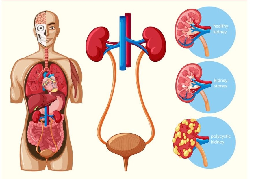 Bệnh Suy Thận - Suy thận là gì? các nguyên nhân và phương pháp điều trị