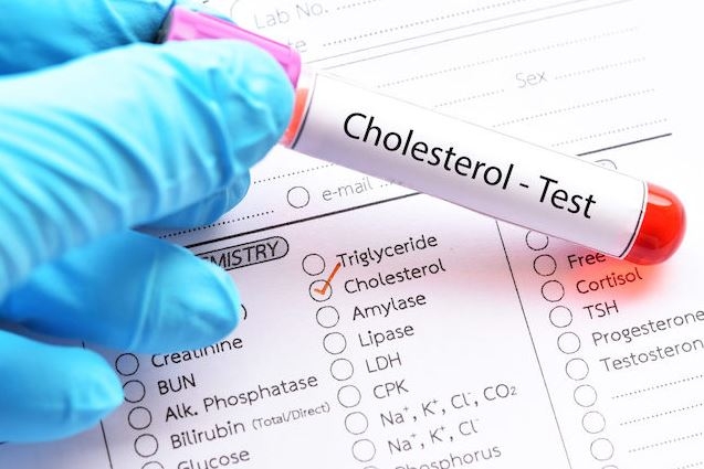 Xét Nghiệm Cholesterol Total Máu: Ý Nghĩa và Tầm Quan Trọng Trong Đánh Giá Sức Khỏe Tim Mạch