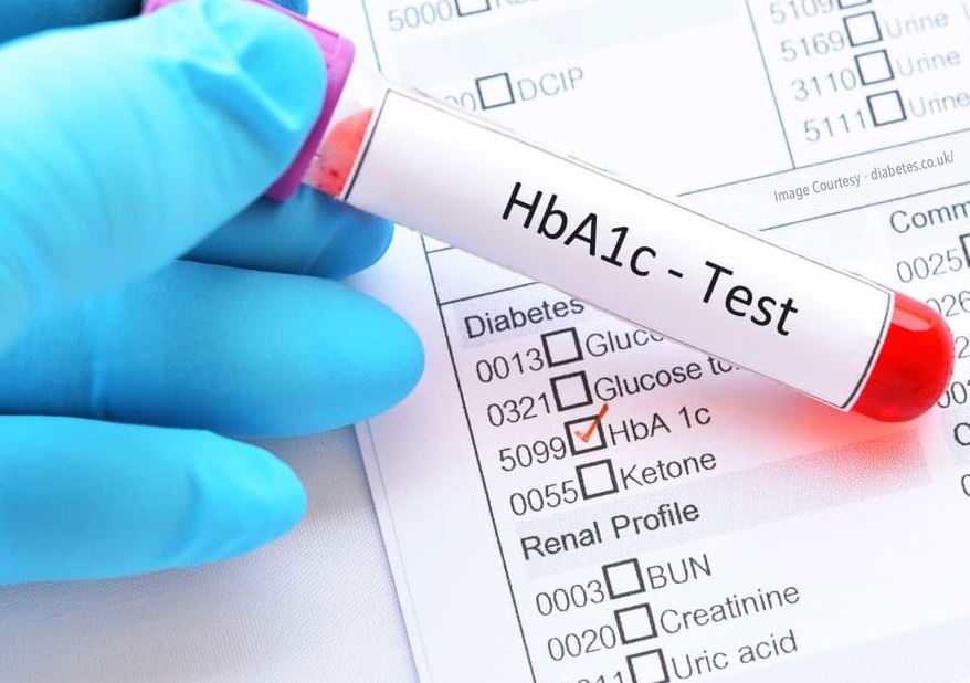 Xét Nghiệm HbA1c: Ý Nghĩa và Ứng Dụng Trong Chẩn Đoán Tiểu Đường